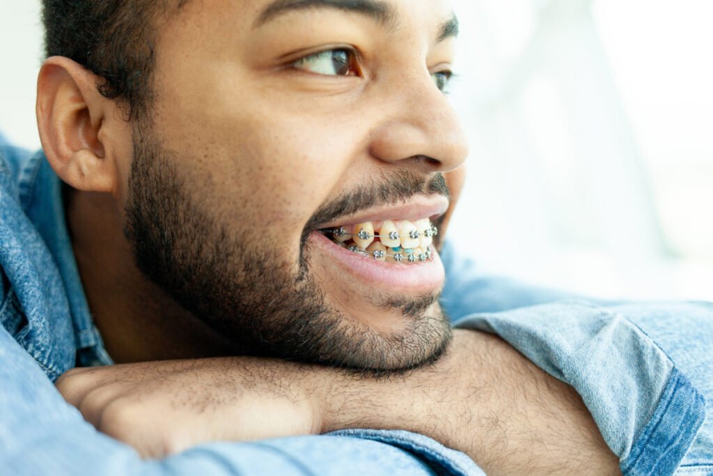 teeth-braces-cost