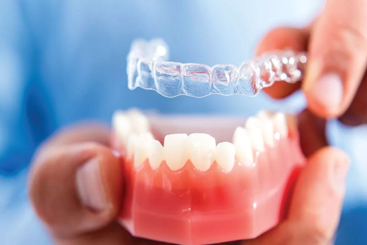 teeth straightening-chennai