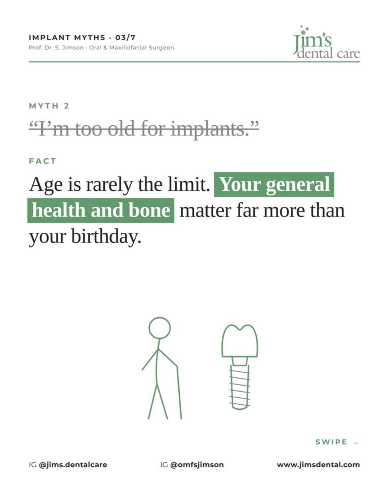 5 myths about dental implants, Jim's Dental Care Chennai