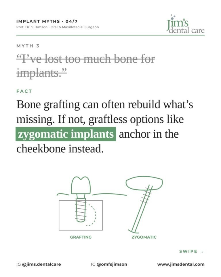 5 myths about dental implants, Jim's Dental Care Chennai