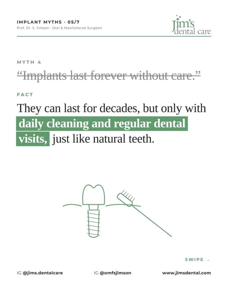 5 myths about dental implants, Jim's Dental Care Chennai